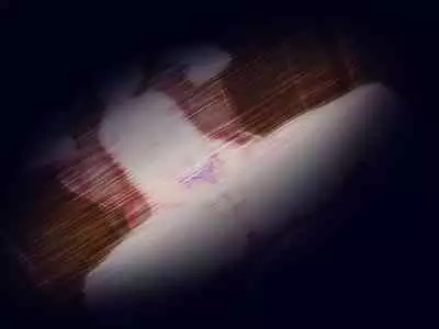 [Re:Set] Yume no sekai de kae rarete